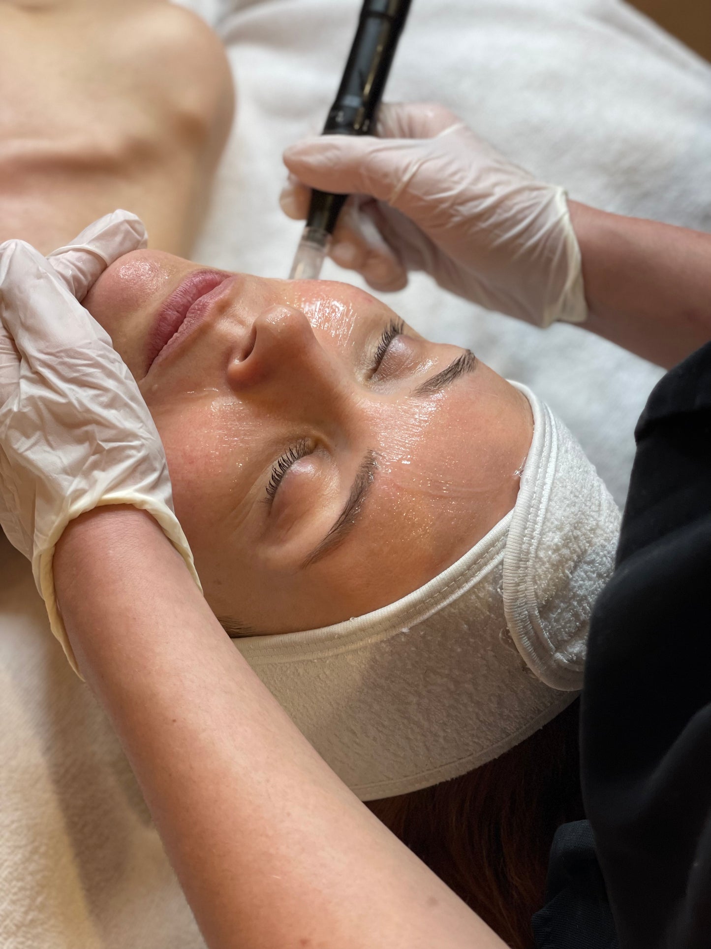 Skin Reset – Cure de 6 soins experts + produits & compléments - Paris 15